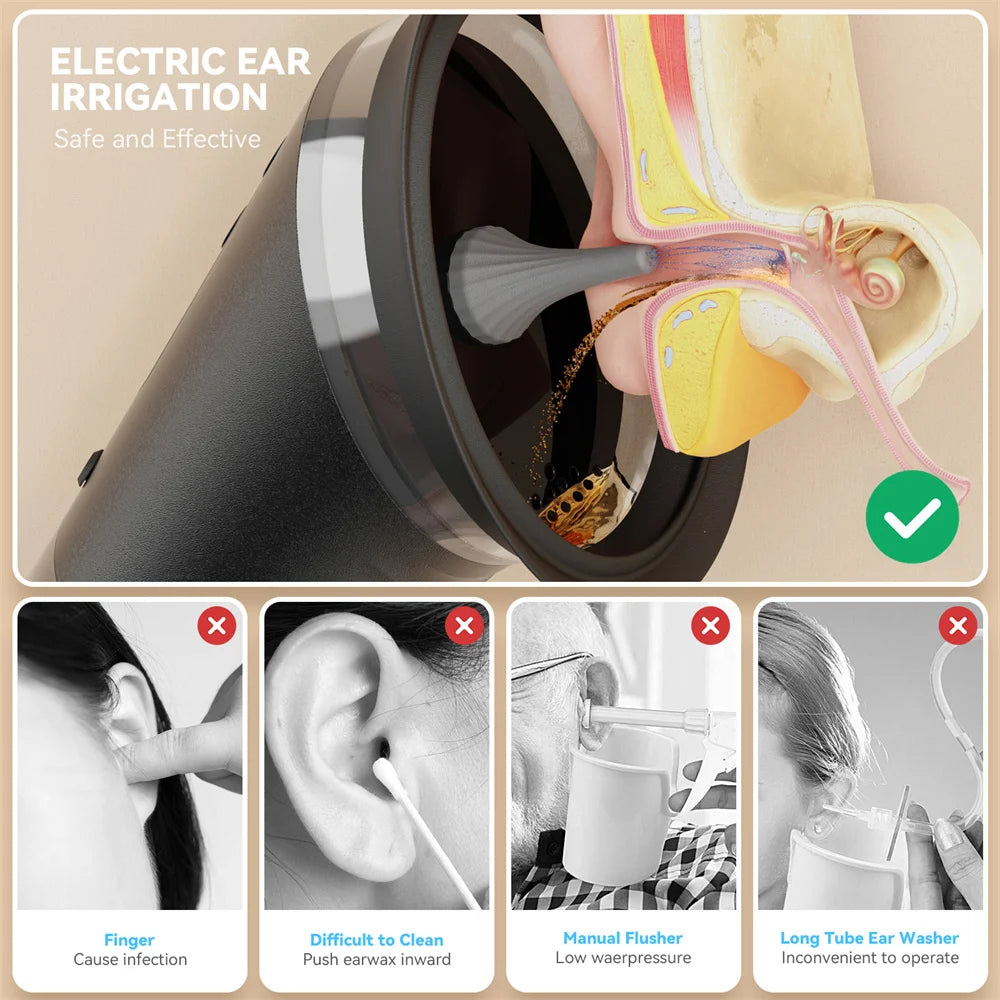 Electric Ear Cleaning System with Water Irrigation and 3 Pressure Settings