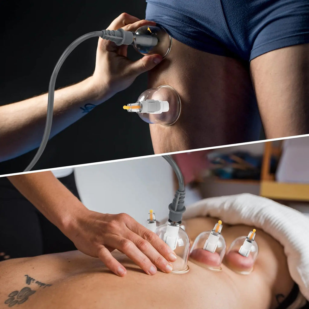 Manual Silicone Cupping Massage Set – Body Suction Cups for Relaxation