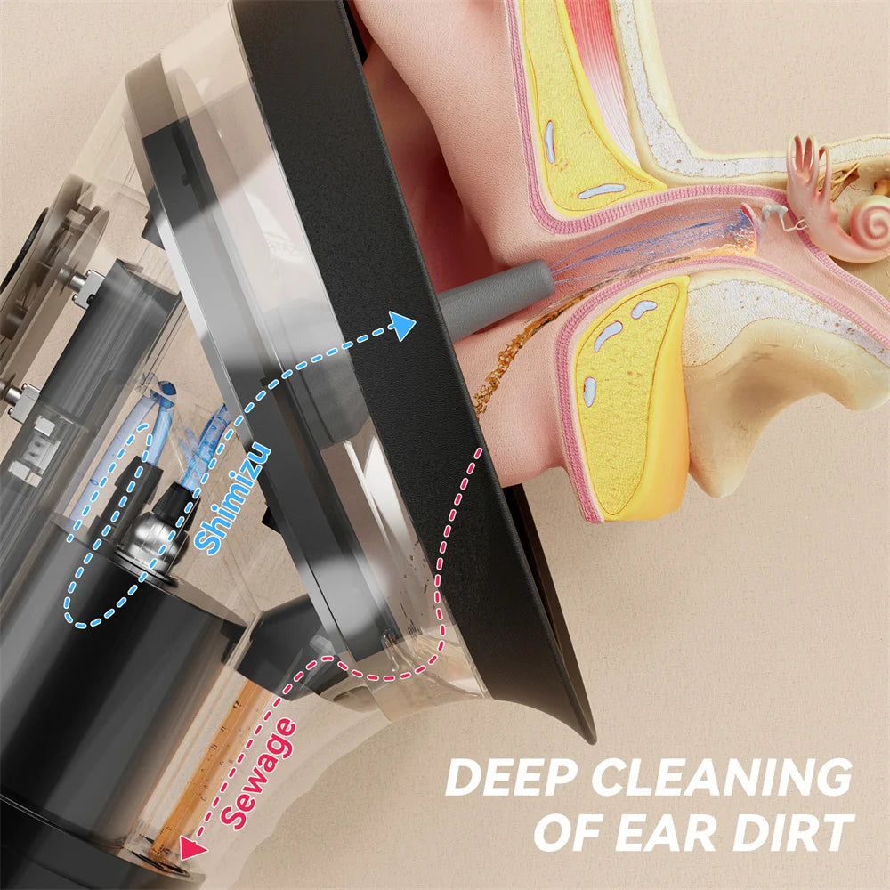 Electric Ear Cleaning System with Water Irrigation and 3 Pressure Settings